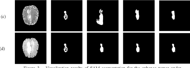 Figure 3 for Segment Anything Model for Brain Tumor Segmentation