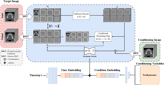 Figure 1 for Tooth-Diffusion: Guided 3D CBCT Synthesis with Fine-Grained Tooth Conditioning