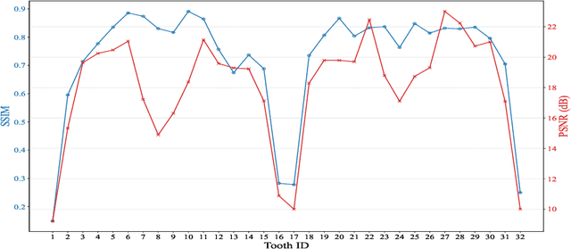 Figure 3 for Tooth-Diffusion: Guided 3D CBCT Synthesis with Fine-Grained Tooth Conditioning