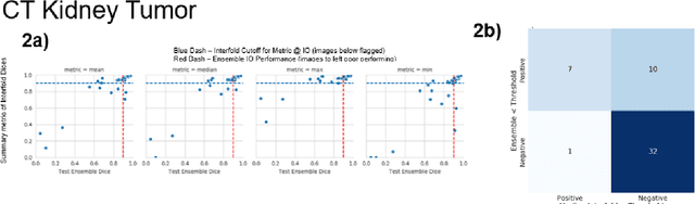 Figure 4 for AI in the Loop -- Functionalizing Fold Performance Disagreement to Monitor Automated Medical Image Segmentation Pipelines
