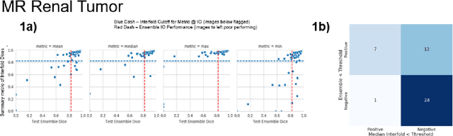 Figure 2 for AI in the Loop -- Functionalizing Fold Performance Disagreement to Monitor Automated Medical Image Segmentation Pipelines