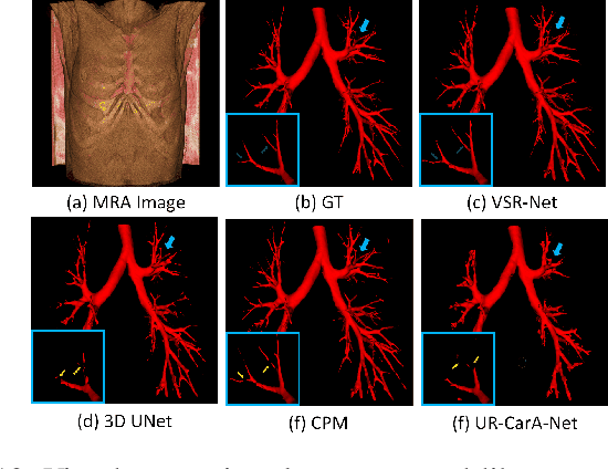 Figure 2 for VSR-Net: Vessel-like Structure Rehabilitation Network with Graph Clustering