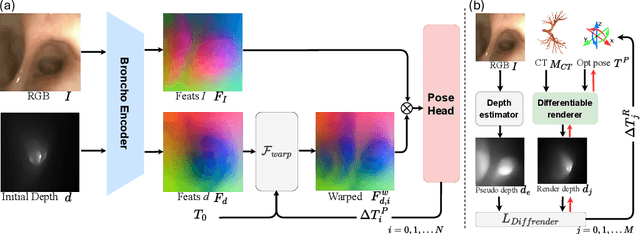 Figure 1 for BronchOpt : Vision-Based Pose Optimization with Fine-Tuned Foundation Models for Accurate Bronchoscopy Navigation