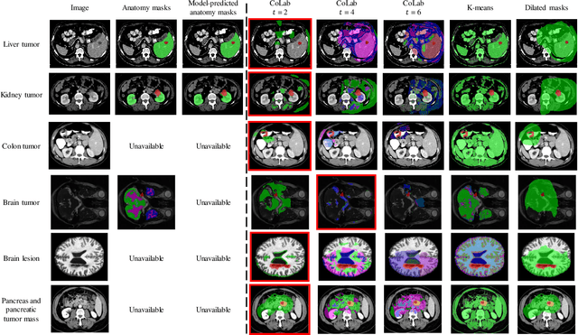 Figure 2 for Context Label Learning: Improving Background Class Representations in Semantic Segmentation