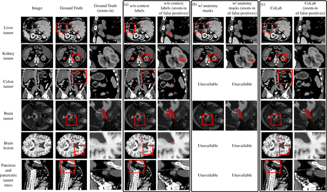 Figure 4 for Context Label Learning: Improving Background Class Representations in Semantic Segmentation