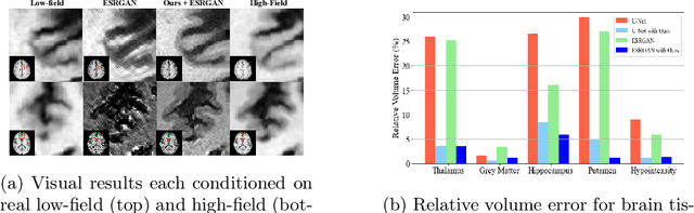 Figure 4 for Tackling Hallucination from Conditional Models for Medical Image Reconstruction with DynamicDPS