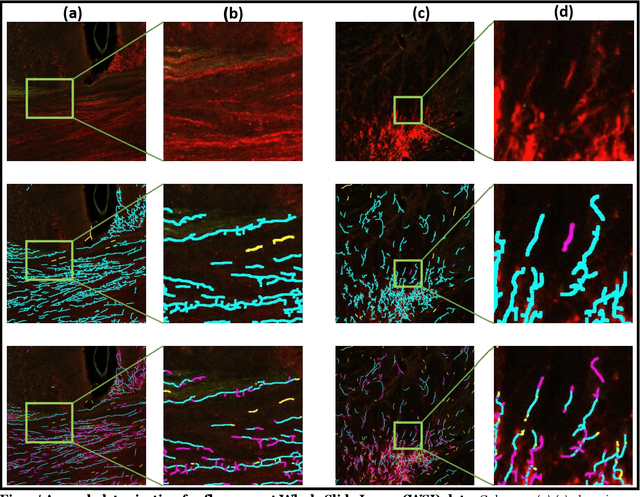 Figure 4 for Skeletonization of neuronal processes using Discrete Morse techniques from computational topology