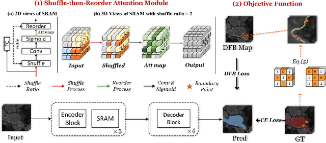 Figure 3 for Dynamic Position Transformation and Boundary Refinement Network for Left Atrial Segmentation