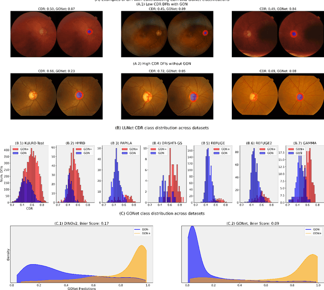 Figure 4 for GONet: A Generalizable Deep Learning Model for Glaucoma Detection