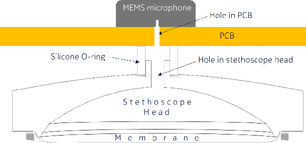Figure 1 for The Patchkeeper: An Integrated Wearable Electronic Stethoscope with Multiple Sensors
