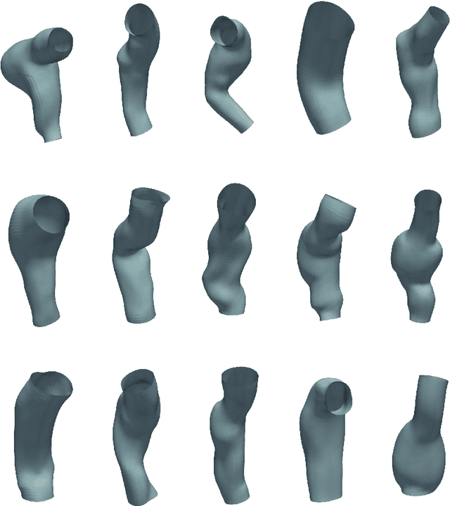 Figure 1 for Graph-Convolution-Beta-VAE for Synthetic Abdominal Aorta Aneurysm Generation