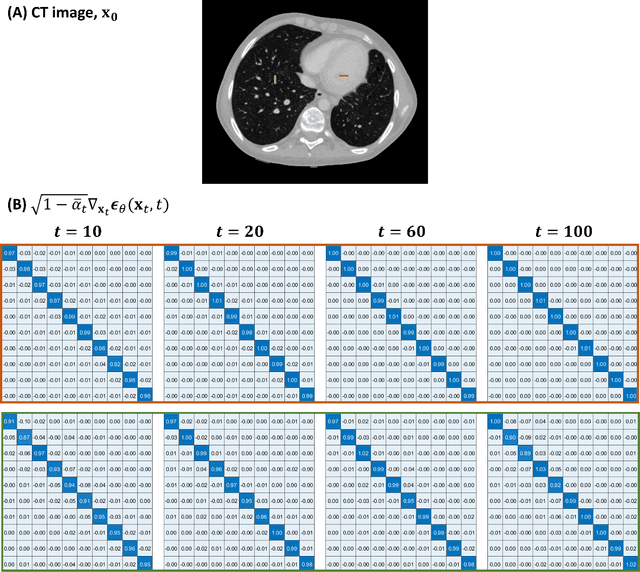 Figure 3 for Strategies for CT Reconstruction using Diffusion Posterior Sampling with a Nonlinear Model