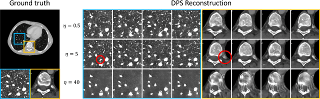 Figure 1 for Strategies for CT Reconstruction using Diffusion Posterior Sampling with a Nonlinear Model