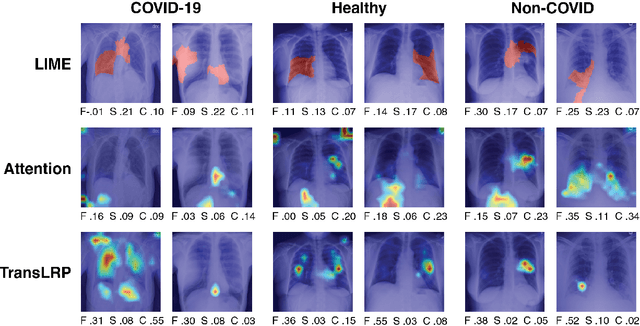 Figure 1 for Towards Evaluating Explanations of Vision Transformers for Medical Imaging