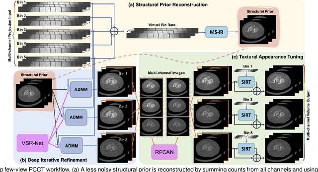 Figure 1 for Deep Few-view High-resolution Photon-counting Extremity CT at Halved Dose for a Clinical Trial