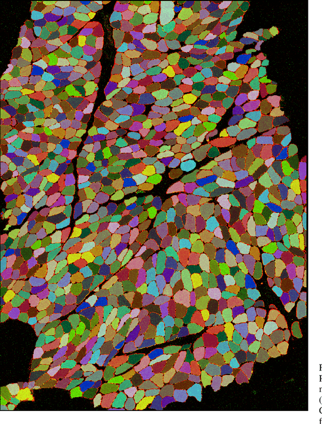 Figure 2 for NCL-SM: A Fully Annotated Dataset of Images from Human Skeletal Muscle Biopsies