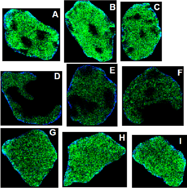 Figure 3 for NCL-SM: A Fully Annotated Dataset of Images from Human Skeletal Muscle Biopsies