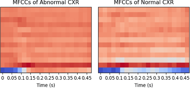 Figure 1 for Leveraging cough sounds to optimize chest x-ray usage in low-resource settings