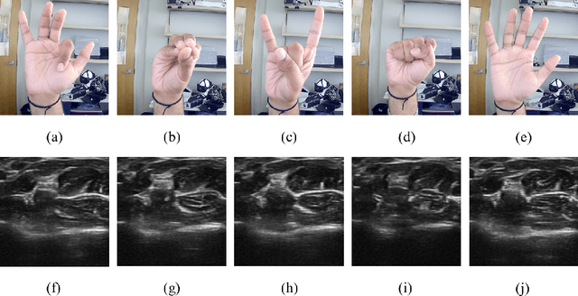 Figure 2 for GPT Sonograpy: Hand Gesture Decoding from Forearm Ultrasound Images via VLM