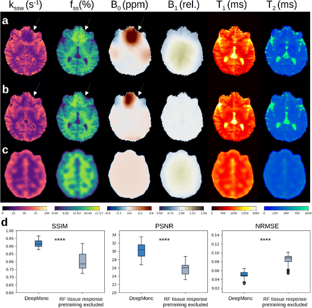 Figure 3 for Decoding the human brain tissue response to radiofrequency excitation using a biophysical-model-free deep MRI on a chip framework