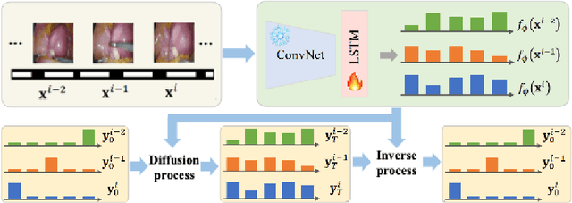 Figure 3 for Meta-SurDiff: Classification Diffusion Model Optimized by Meta Learning is Reliable for Online Surgical Phase Recognition