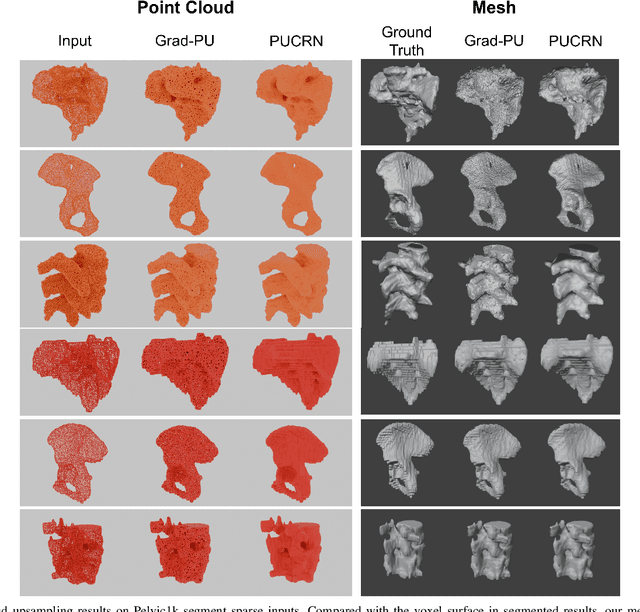 Figure 3 for Point Cloud Upsampling as Statistical Shape Model for Pelvic