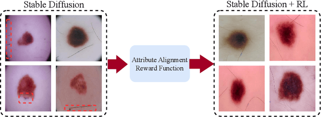 Figure 1 for RL4Med-DDPO: Reinforcement Learning for Controlled Guidance Towards Diverse Medical Image Generation using Vision-Language Foundation Models