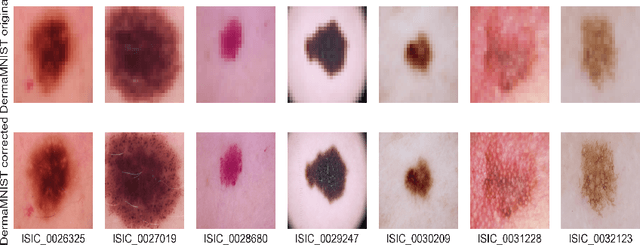 Figure 1 for Improving Diagnostic Accuracy of Pigmented Skin Lesions With CNNs: an Application on the DermaMNIST Dataset
