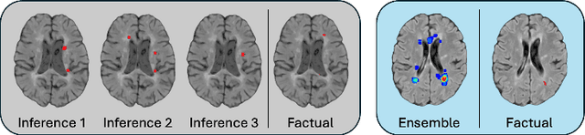 Figure 4 for Spatio-Temporal Conditional Diffusion Models for Forecasting Future Multiple Sclerosis Lesion Masks Conditioned on Treatments