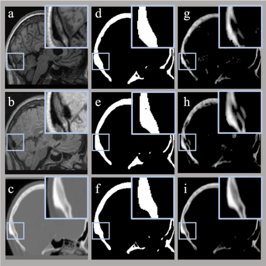 Figure 2 for Enhancing CT Image synthesis from multi-modal MRI data based on a multi-task neural network framework