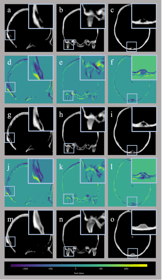 Figure 4 for Enhancing CT Image synthesis from multi-modal MRI data based on a multi-task neural network framework