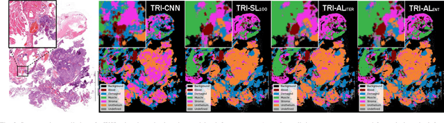 Figure 3 for Active Learning Based Domain Adaptation for Tissue Segmentation of Histopathological Images