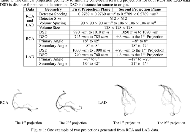 Figure 1 for NeCA: 3D Coronary Artery Tree Reconstruction from Two 2D Projections by Neural Implicit Representation