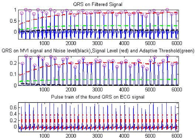 Figure 1 for Comparison of HRV Indices of ECG and BCG Signals