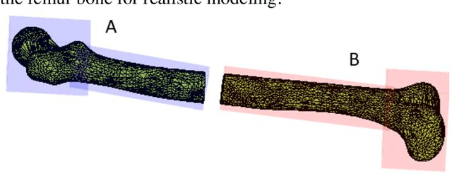 Figure 4 for Haptic-Enhanced Virtual Reality Simulator for Robot-Assisted Femur Fracture Surgery
