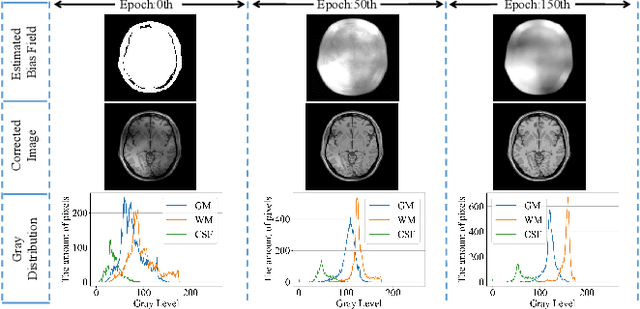 Figure 1 for Unsupervised Decomposition Networks for Bias Field Correction in MR Image