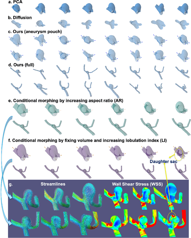 Figure 4 for Two-Stage Generative Model for Intracranial Aneurysm Meshes with Morphological Marker Conditioning
