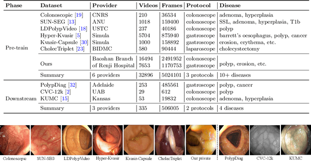 Figure 2 for Foundation Model for Endoscopy Video Analysis via Large-scale Self-supervised Pre-train