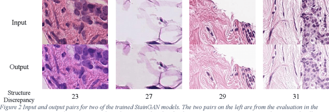 Figure 2 for When normalization hallucinates: unseen risks in AI-powered whole slide image processing