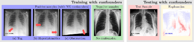 Figure 1 for Right for the Wrong Reason: Can Interpretable ML Techniques Detect Spurious Correlations?
