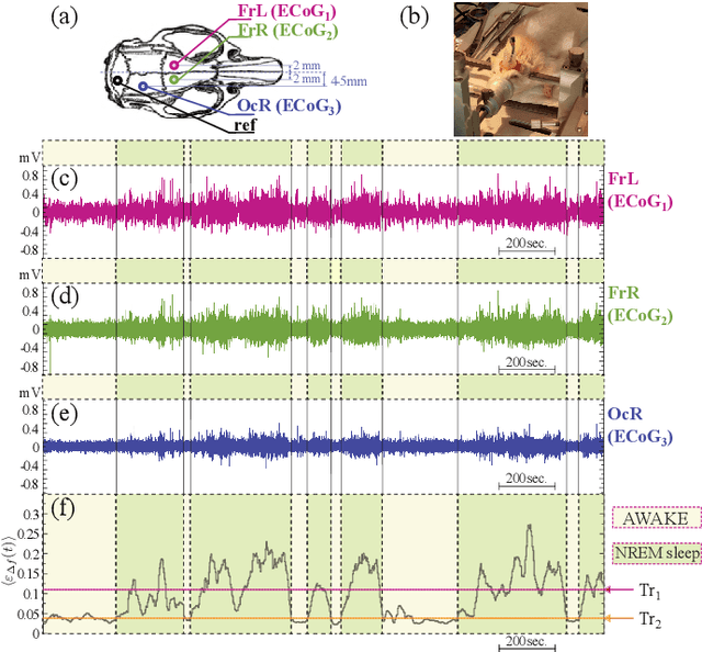 Figure 1 for Simple method for detecting sleep episodes in rats ECoG using machine learning