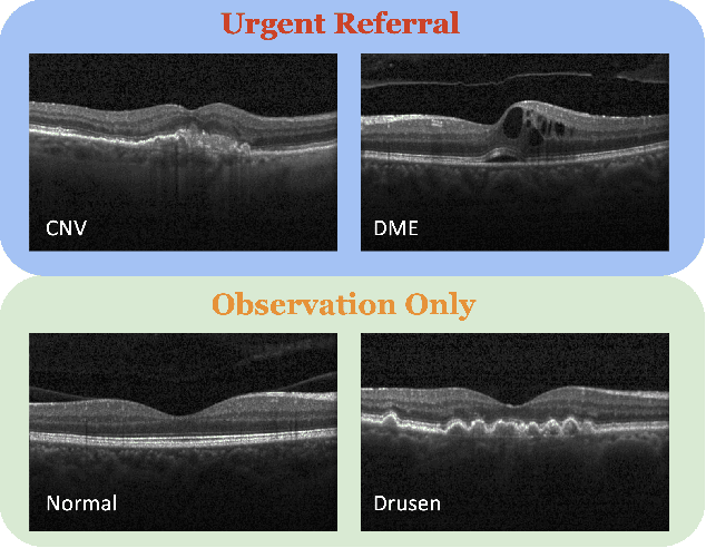 Figure 1 for Self-Supervised Learning Featuring Small-Scale Image Dataset for Treatable Retinal Diseases Classification