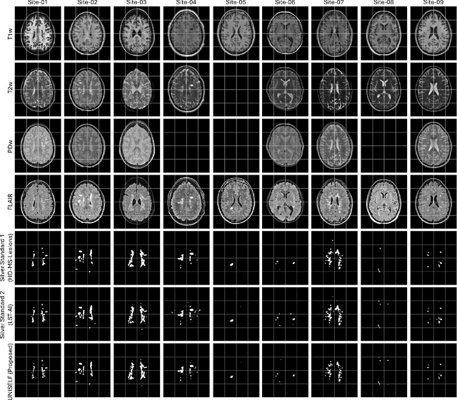 Figure 3 for UNISELF: A Unified Network with Instance Normalization and Self-Ensembled Lesion Fusion for Multiple Sclerosis Lesion Segmentation
