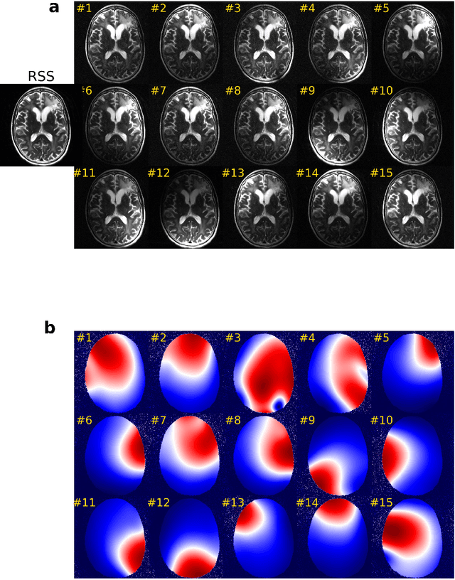 Figure 1 for Advancing MRI Reconstruction: A Systematic Review of Deep Learning and Compressed Sensing Integration