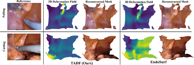 Figure 4 for Tracking-Aware Deformation Field Estimation for Non-rigid 3D Reconstruction in Robotic Surgeries