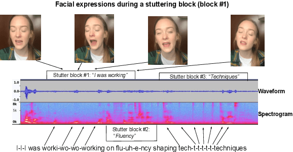Figure 1 for MMSD-Net: Towards Multi-modal Stuttering Detection