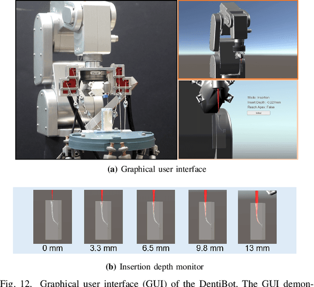 Figure 4 for DentiBot: System Design and 6-DoF Hybrid Position/Force Control for Robot-Assisted Endodontic Treatment