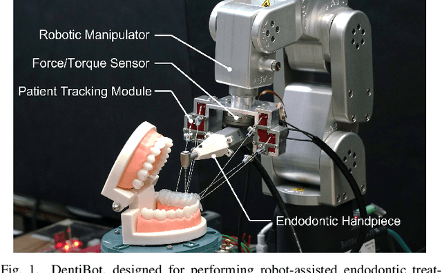 Figure 1 for DentiBot: System Design and 6-DoF Hybrid Position/Force Control for Robot-Assisted Endodontic Treatment