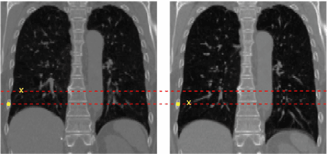 Figure 3 for Sliding at first order: Higher-order momentum distributions for discontinuous image registration