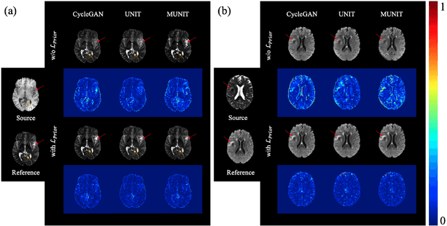 Figure 4 for Reliable Multi-modal Medical Image-to-image Translation Independent of Pixel-wise Aligned Data